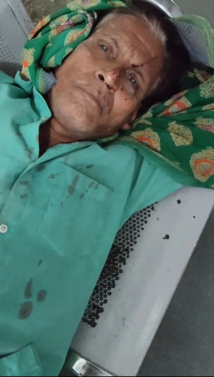 हमीरपुर :पैसे के लेनदेन को लेकर युवक पर लाठी-डंडों से हमला, सिर में गंभीर चोट,पति को देखने अस्पताल जा रही महिला से भी मारपीट का आरोप, पुलिस को दी तहरीर